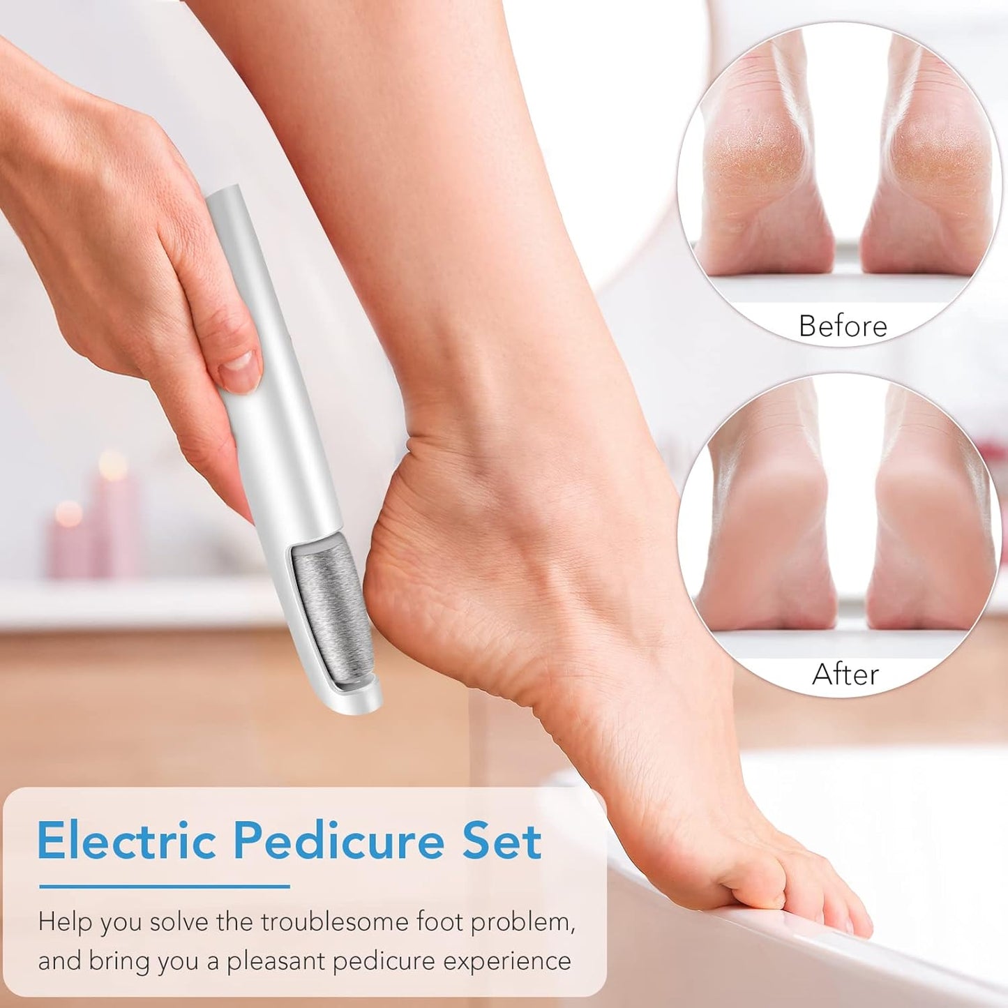 Electric Callus Remover for Feet